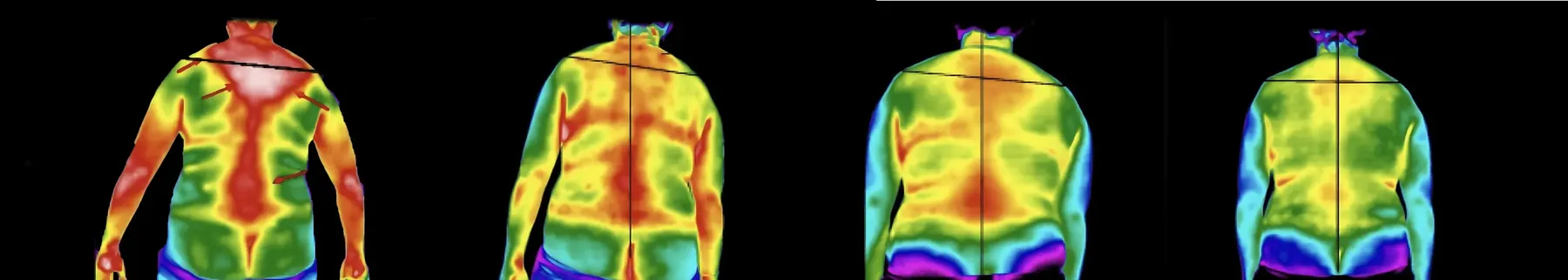 Examples of thermal imaging scans used at Life Charge Chiropractic