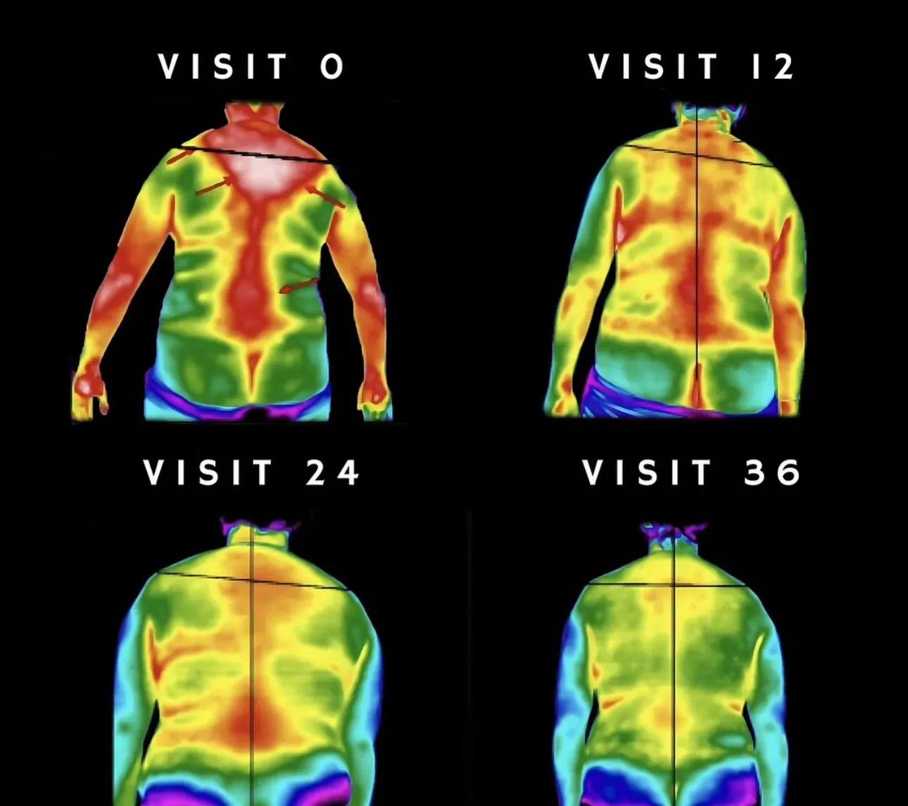 Visit 0 to 18