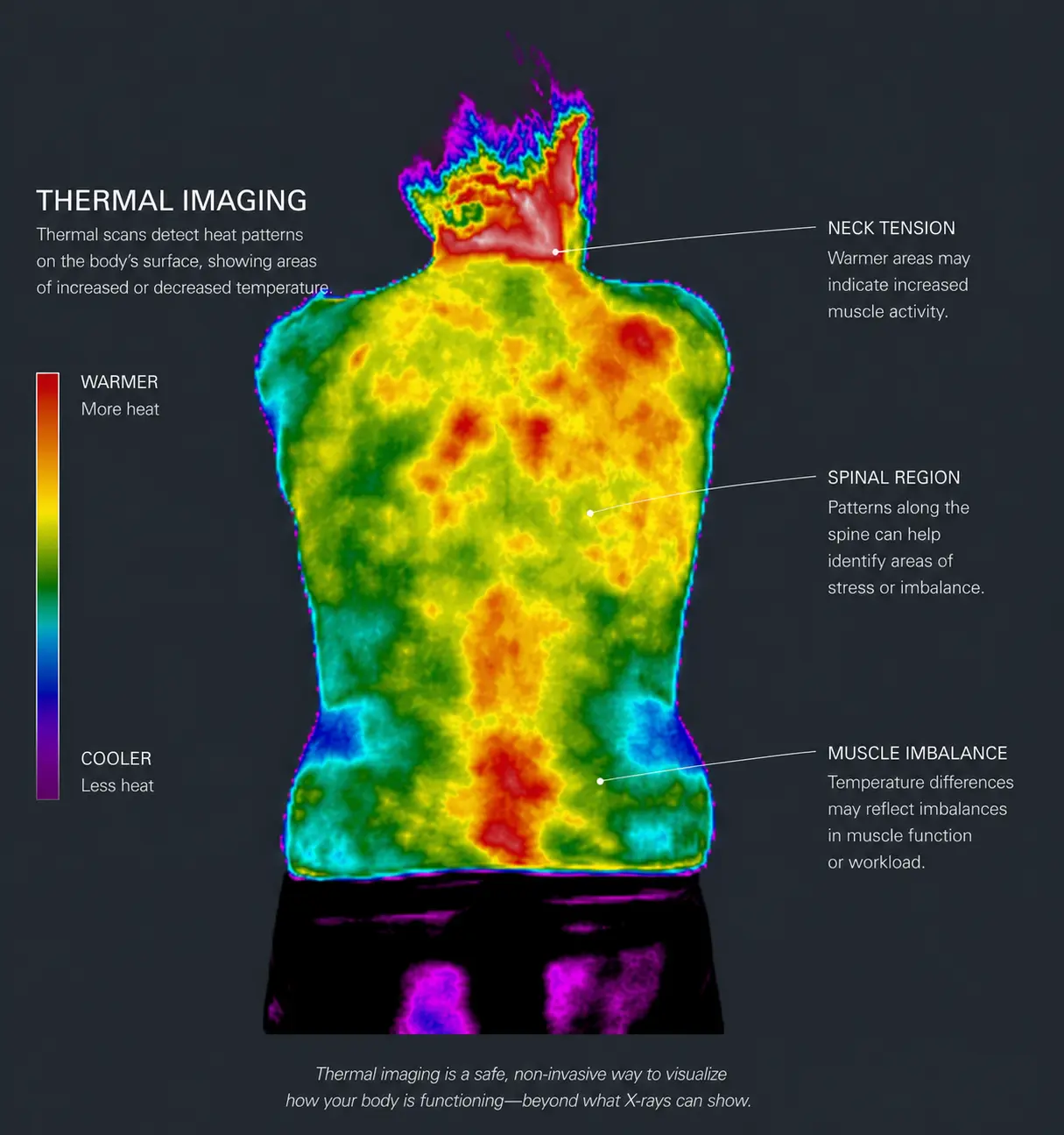 Whole-back thermal imaging scan at Life Charge Chiropractic
