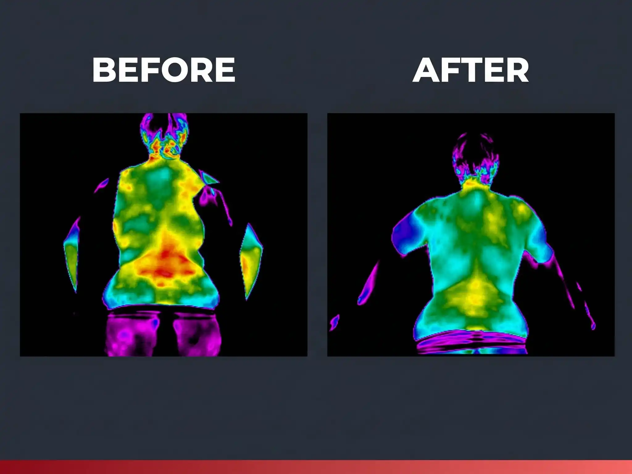 Thermal scan before and after care