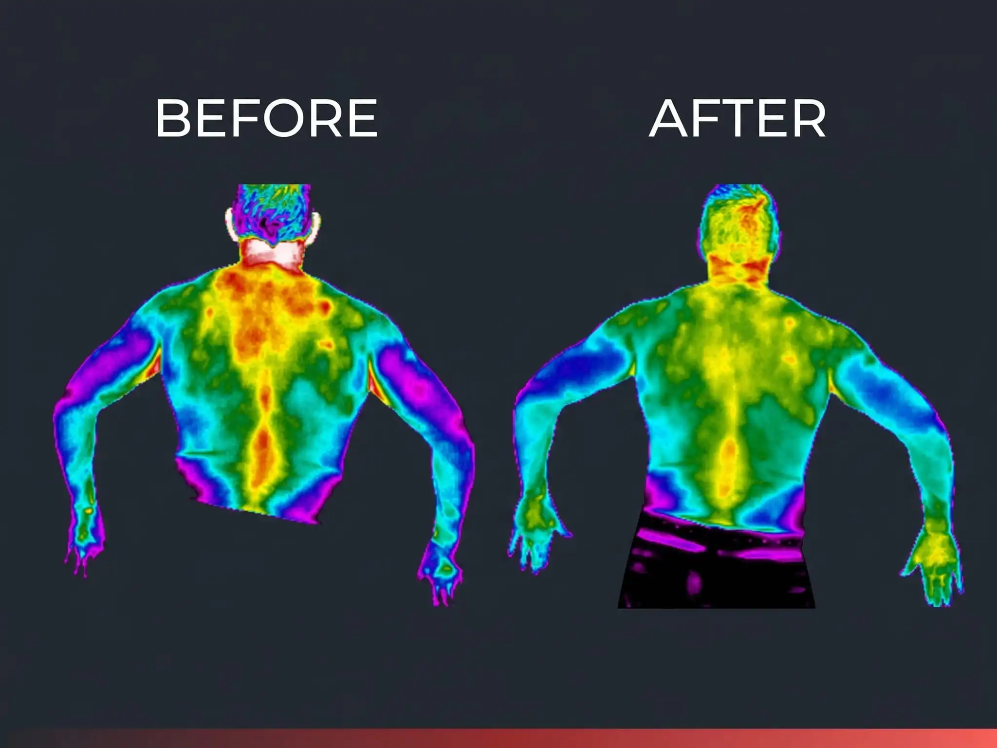 Thermal scan before and after care