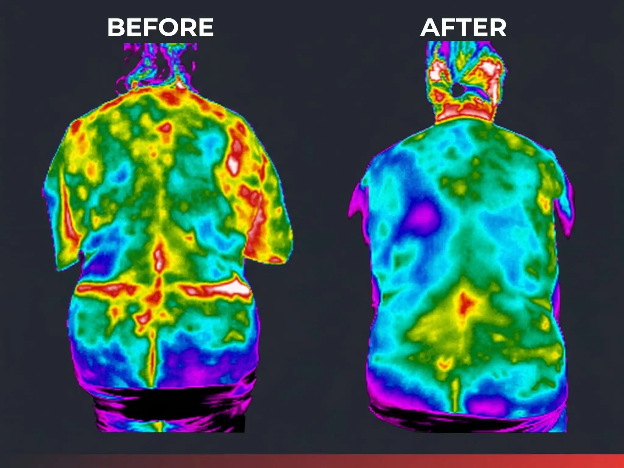 Thermal scan before and after care
