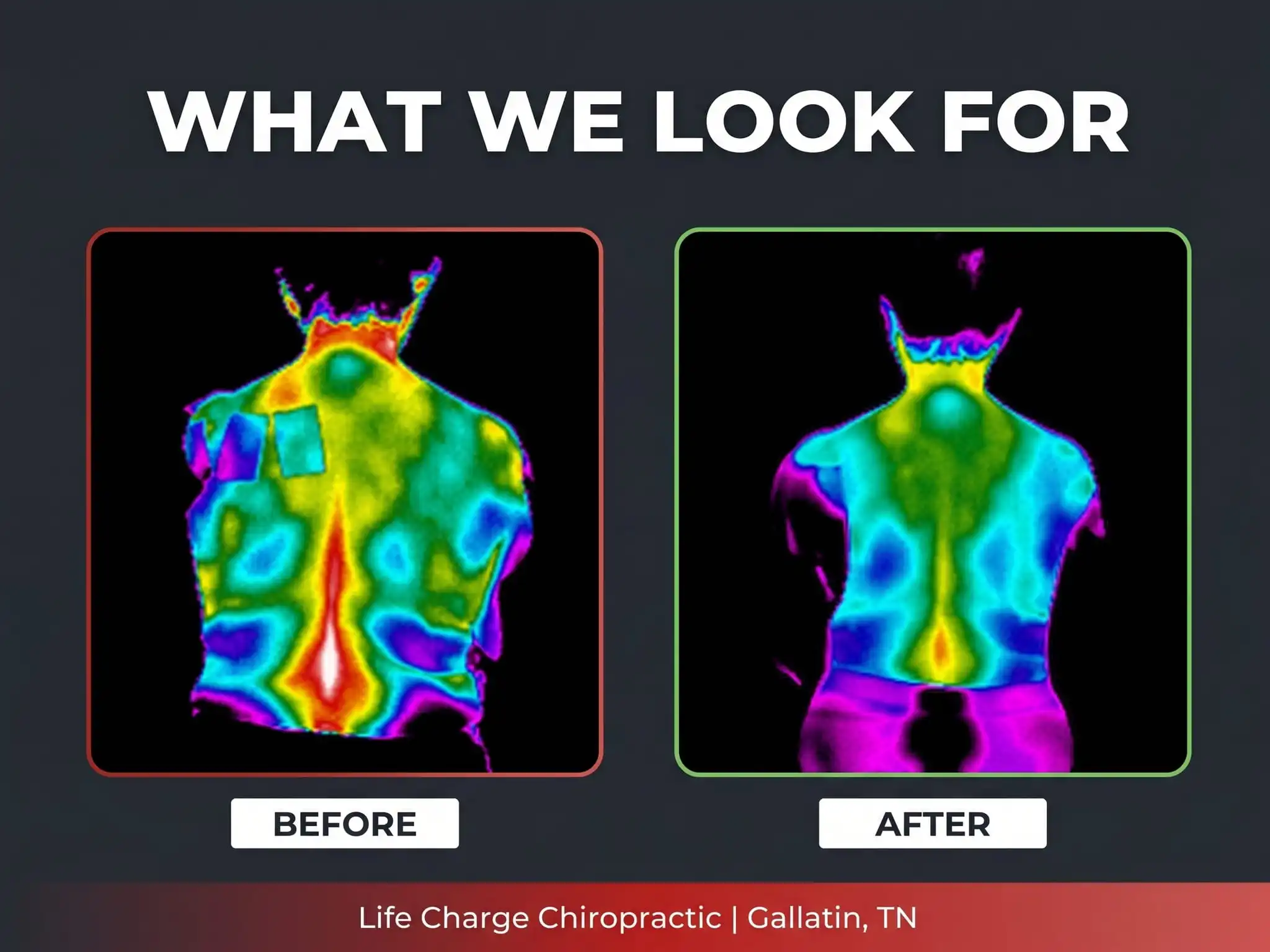 Thermal scan before and after care