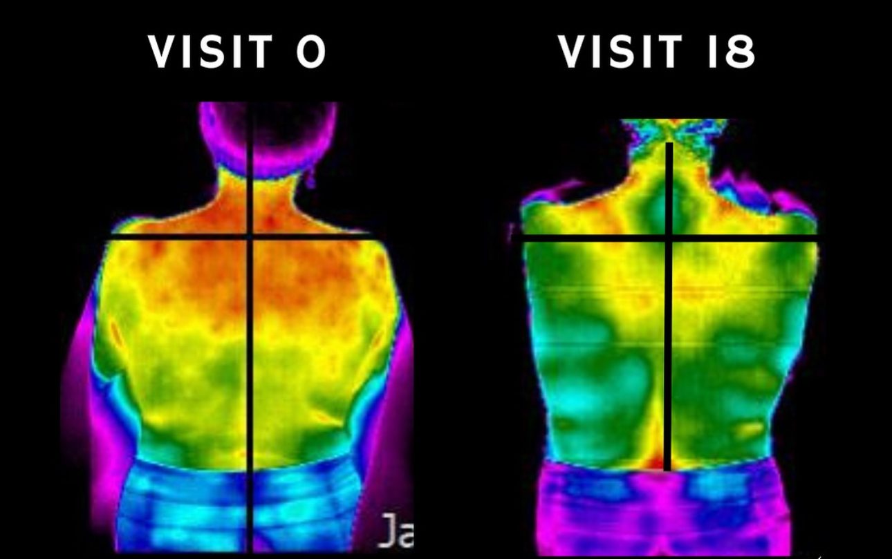 Before and after thermal imaging showing improved nervous system symmetry