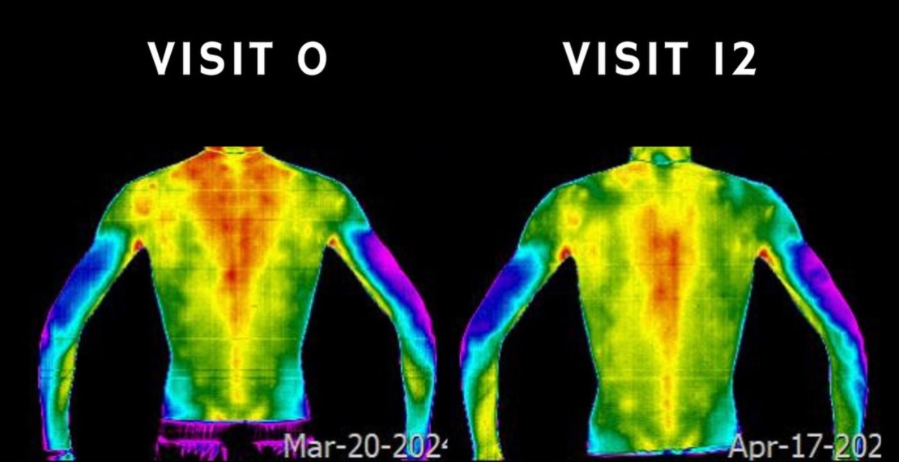 Detailed thermal scan of a spine showing temperature variations